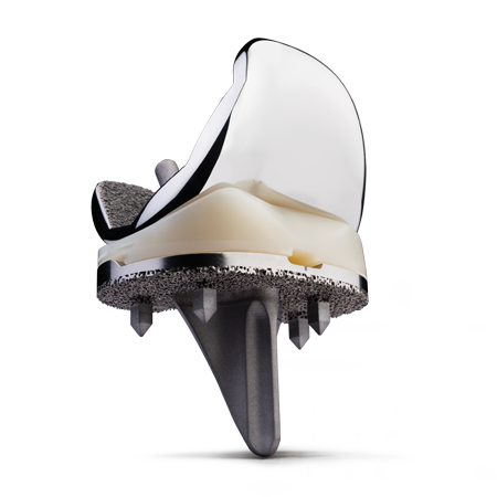 Persona® OsseoTi Keel Tibia from Zimmer Biomet